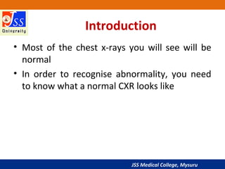 JSS Medical College, Mysuru
Introduction
• Most of the chest x-rays you will see will be
normal
• In order to recognise abnormality, you need
to know what a normal CXR looks like
 