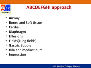 JSS Medical College, Mysuru
ABCDEFGHI approach
• Airway
• Bones and Soft tissue
• Cardia
• Diaphragm
• Effusions
• Fields(Lung fields)
• Gastric Bubble
• Hila and mediastinum
• Impression
 