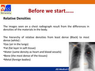JSS Medical College, Mysuru
Before we start……
Relative Densities
The images seen on a chest radiograph result from the differences in
densities of the materials in the body.
The hierarchy of relative densities from least dense (Black) to most
dense (white) :
•Gas (air in the lungs)
•Fat (fat layer in soft tissue)
•Water (same density as heart and blood vessels)
•Bone (the most dense of the tissues)
•Metal (foreign bodies)
 