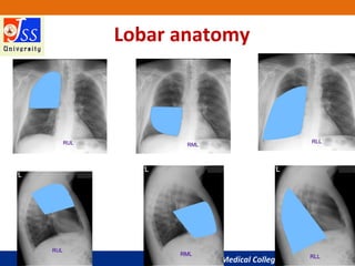 JSS Medical College, Mysuru
Lobar anatomy
 