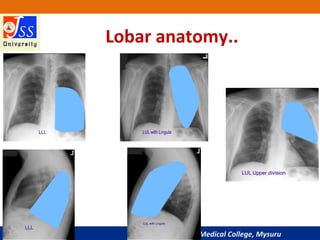 JSS Medical College, Mysuru
Lobar anatomy..
 