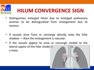 JSS Medical College, Mysuru
HILUM CONVERGENCE SIGN
• Distinguishes enlarged hilum due to enlarged pulmonary
arteries to be distinguished from enlargement due to
tumour.
• If vessels arise from or converge directly onto the hilar
shadow — then the enlargement is vascular.
• If the vessels appear to arise or converge medial to the
lateral aspect of the hilar shadow — then the enlargement is
a mass
 
