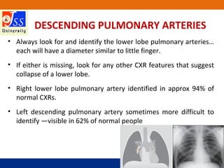 JSS Medical College, Mysuru
DESCENDING PULMONARY ARTERIES
• Always look for and identify the lower lobe pulmonary arteries…
each will have a diameter similar to little finger.
• If either is missing, look for any other CXR features that suggest
collapse of a lower lobe.
• Right lower lobe pulmonary artery identified in approx 94% of
normal CXRs.
• Left descending pulmonary artery sometimes more difficult to
identify —visible in 62% of normal people
 