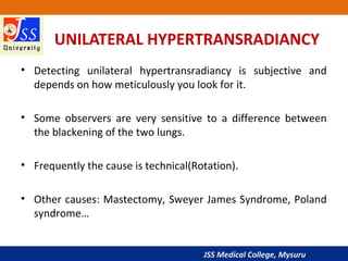 JSS Medical College, Mysuru
UNILATERAL HYPERTRANSRADIANCY
• Detecting unilateral hypertransradiancy is subjective and
depends on how meticulously you look for it.
• Some observers are very sensitive to a difference between
the blackening of the two lungs.
• Frequently the cause is technical(Rotation).
• Other causes: Mastectomy, Sweyer James Syndrome, Poland
syndrome…
 