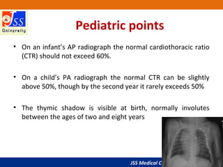 JSS Medical College, Mysuru
Pediatric points
• On an infant’s AP radiograph the normal cardiothoracic ratio
(CTR) should not exceed 60%.
• On a child’s PA radiograph the normal CTR can be slightly
above 50%, though by the second year it rarely exceeds 50%
• The thymic shadow is visible at birth, normally involutes
between the ages of two and eight years
 