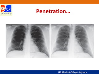 JSS Medical College, Mysuru
Penetration…
 