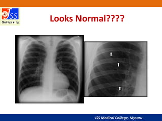 JSS Medical College, Mysuru
Looks Normal????
 