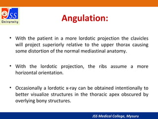 JSS Medical College, Mysuru
Angulation:
• With the patient in a more lordotic projection the clavicles
will project superi...