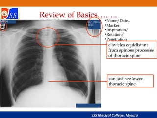 Precision in Imaging: Expert Radiology Interpretation