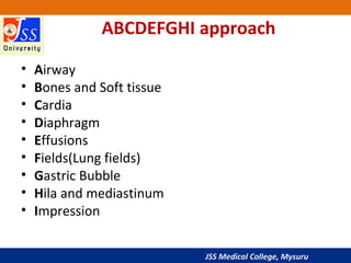 JSS Medical College, Mysuru
ABCDEFGHI approach
• Airway
• Bones and Soft tissue
• Cardia
• Diaphragm
• Effusions
• Fields(...