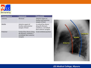 Approach to Chest X-Ray and Interpretation
