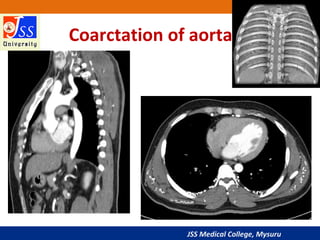 Approach to Chest X-Ray and Interpretation