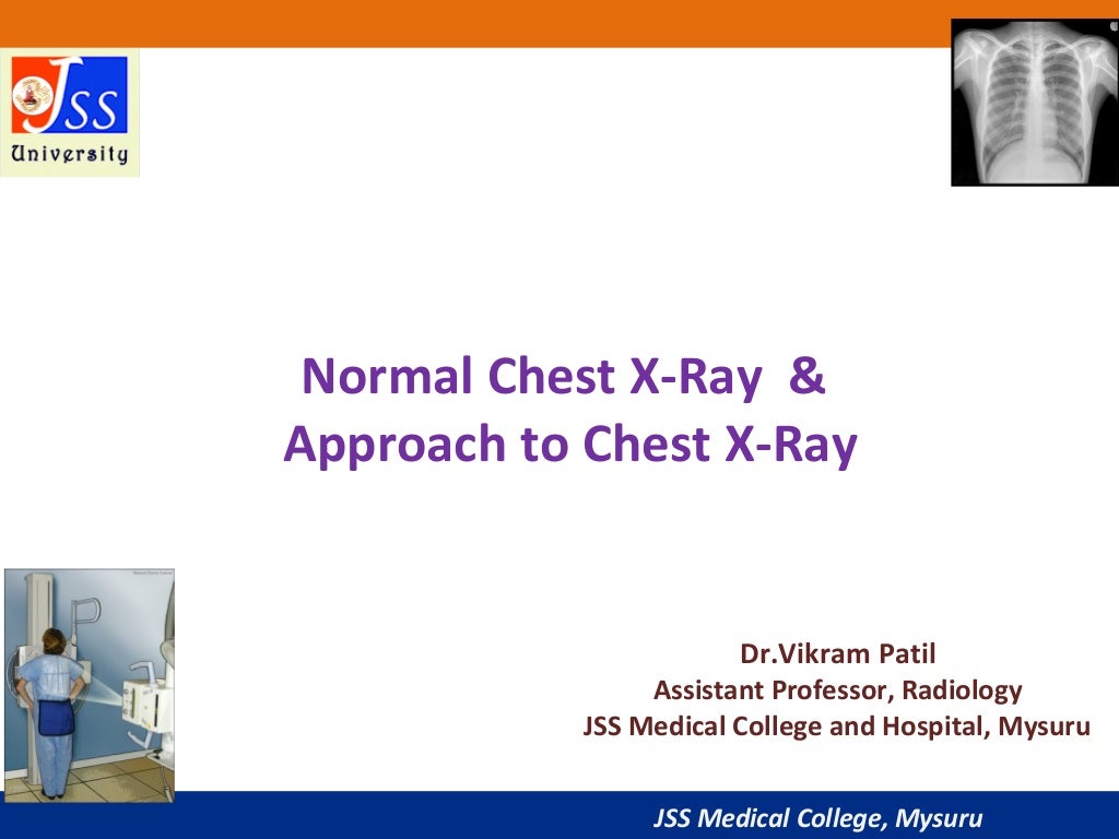 Approach to Chest XRay and Interpretation