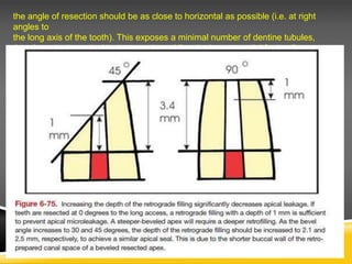 the angle of resection should be as close to horizontal as possible (i.e. at right
angles to
the long axis of the tooth). This exposes a minimal number of dentine tubules,
thereby reducing apical leakage and providing the best potential for healing
 