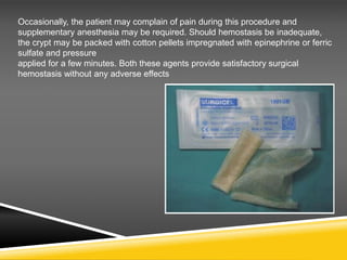 Occasionally, the patient may complain of pain during this procedure and
supplementary anesthesia may be required. Should hemostasis be inadequate,
the crypt may be packed with cotton pellets impregnated with epinephrine or ferric
sulfate and pressure
applied for a few minutes. Both these agents provide satisfactory surgical
hemostasis without any adverse effects
 