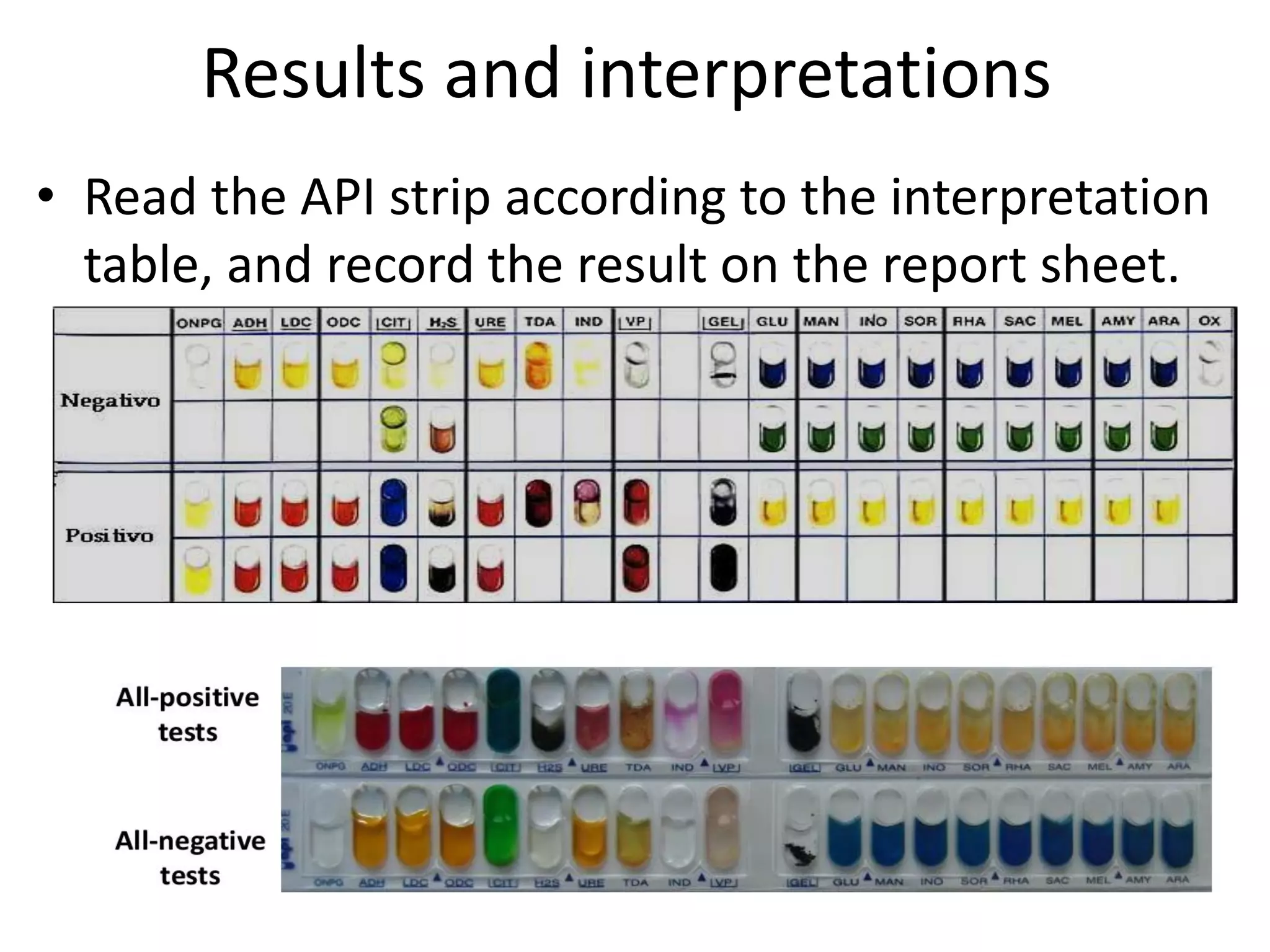Results and interpretations
• Read the API strip according to the interpretation
table, and record the result on the report sheet.
 