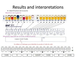 Api 20 e | PDF