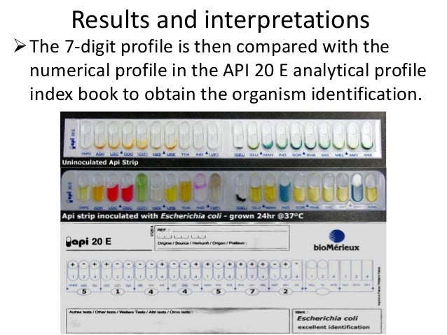 Api 20e Color Chart