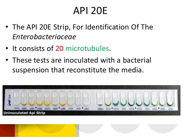 Api 20e Color Chart