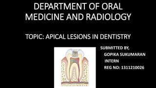 DEPARTMENT OF ORAL
MEDICINE AND RADIOLOGY
TOPIC: APICAL LESIONS IN DENTISTRY
SUBMITTED BY,
GOPIKA SUKUMARAN
INTERN
REG NO: 1311210026
 