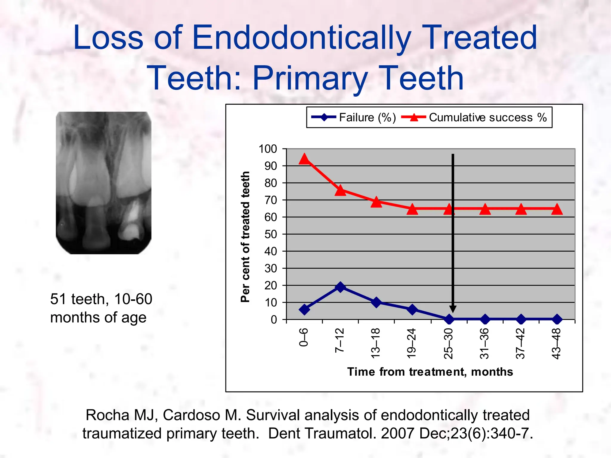 Loss of Endodontically Treated
Teeth: Primary Teeth
Rocha MJ, Cardoso M. Survival analysis of endodontically treated
traumatized primary teeth. Dent Traumatol. 2007 Dec;23(6):340-7.
51 teeth, 10-60
months of age 0
10
20
30
40
50
60
70
80
90
100
0–6
7–12
13–18
19–24
25–30
31–36
37–42
43–48
Time from treatment, months
Per
cent
of
treated
teeth
Failure (%) Cumulative success %
 