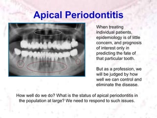 Apical Periodontitis
How well do we do? What is the status of apical periodontitis in
the population at large? We need to respond to such issues.
When treating
individual patients,
epidemiology is of little
concern, and prognosis
of interest only in
predicting the fate of
that particular tooth.
But as a profession, we
will be judged by how
well we can control and
eliminate the disease.
 