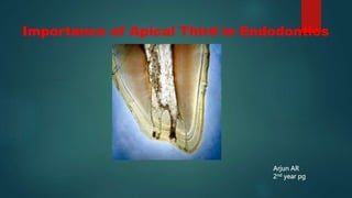 Importance of Apical Third in Endodontics
Arjun AR
2nd year pg
 