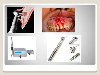 Apicoectomy | PPTX