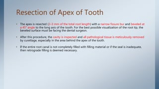 Resection of Apex of Tooth
• The apex is resected (2–3 mm of the total root length) with a narrow fissure bur and beveled at
a 45° angle to the long axis of the tooth. For the best possible visualization of the root tip, the
beveled surface must be facing the dental surgeon.
• After this procedure, the cavity is inspected and all pathological tissue is meticulously removed
by curettage, especially in the area behind the apex of the tooth.
• If the entire root canal is not completely filled with filling material or if the seal is inadequate,
then retrograde filling is deemed necessary.
 