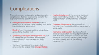 Complications
The most common perioperative and postoperative
complications that may occur during and after the
surgical procedure, respectively, are:
• Damage to the anatomic structures in case of
penetration of the nasal cavity, maxillary sinus and
mandibular canal with the bur.
• Bleeding from the greater palatine artery during
apicoectomy of palatal root.
• Splattering of amalgam at the operation site, due
to inadequate apical isolation and improper
manipulations for removal of excess filling
material.
• Staining of mucosa due to amalgam that
remained at the surgical field (amalgam tattoo).
• Healing disturbances, if the semilunar incision is
made over the bony deficit or if the flap, after
reapproximation, is not positioned on healthy
bone.
• Dislodged filling material due to superficial
placement, as a result of insufficient preparation of
apical cavity.
• Incomplete root resection, due to insufficient
access or visualization and misjudged length of
root. As a result, the apical portion of the root
remains in position and the retrograde filling is
placed improperly, with all the resulting
consequences.
 