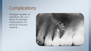 Complications
Amalgam splatter at
operation site, as a
result of improper
manipulations for
removal of excess
material
 