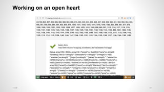 Working on an open heart
3312:28
 