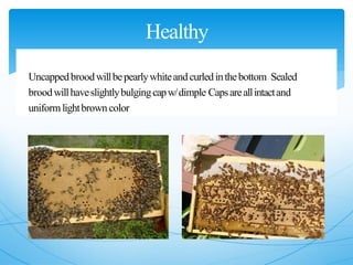 Healthy
Brood
Uncappedbroodwillbepearlywhiteandcurledinthebottom Sealed
broodwillhaveslightlybulgingcapw/dimple Capsareallintactand
uniformlightbrowncolor
 