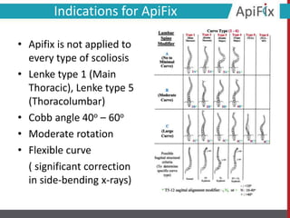 Indications for ApiFix
• Apifix is not applied to
every type of scoliosis
• Lenke type 1 (Main
Thoracic), Lenke type 5
(Thoracolumbar)
• Cobb angle 40ο – 60ο
• Moderate rotation
• Flexible curve
( significant correction
in side-bending x-rays)
 