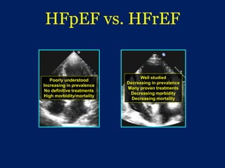 HFpEF vs. HFrEF
Poorly understood
Increasing in prevalence
No definitive treatments
High morbidity/mortality
Well studied
Decreasing in prevalence
Many proven treatments
Decreasing morbidity
Decreasing mortality
 