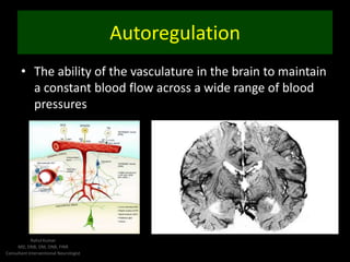 Management of Ischemic Stroke | PPTX