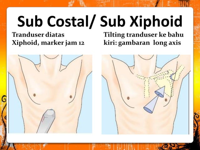Apikal view,subcostal view,dan supra sternal view | PPT