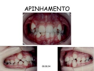 APINHAMENTO08.08.94
