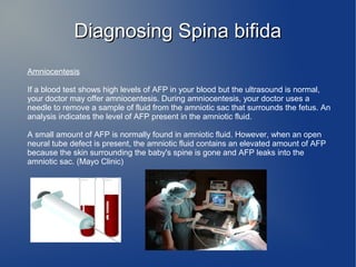 DDiiaaggnnoossiinngg SSppiinnaa bbiiffiiddaa 
Amniocentesis 
If a blood test shows high levels of AFP in your blood but the ultrasound is normal, 
your doctor may offer amniocentesis. During amniocentesis, your doctor uses a 
needle to remove a sample of fluid from the amniotic sac that surrounds the fetus. An 
analysis indicates the level of AFP present in the amniotic fluid. 
A small amount of AFP is normally found in amniotic fluid. However, when an open 
neural tube defect is present, the amniotic fluid contains an elevated amount of AFP 
because the skin surrounding the baby's spine is gone and AFP leaks into the 
amniotic sac. (Mayo Clinic) 
 
