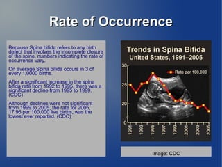 RRaattee ooff OOccccuurrrreennccee 
Because Spina bifida refers to any birth 
defect that involves the incomplete closure 
of the spine, numbers indicating the rate of 
occurrence vary. 
On average Spina bifida occurs in 3 of 
every 1,0000 births. 
After a significant increase in the spina 
bifida rate from 1992 to 1995, there was a 
significant decline from 1995 to 1999. 
(CDC) 
Although declines were not significant 
from 1999 to 2005, the rate for 2005, 
17.96 per 100,000 live births, was the 
lowest ever reported. (CDC) 
Image: CDC 
 