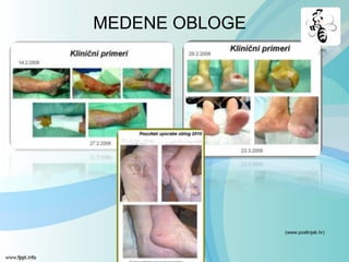 MEDENE OBLOGE
(www.pcelinjak.hr)
 
