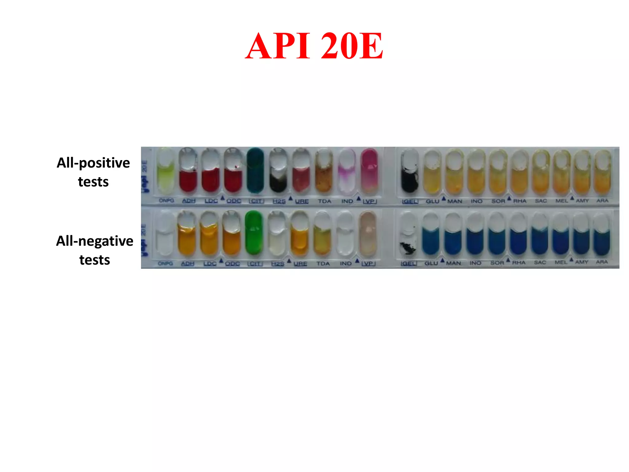 All-negative tests 
All-positive tests 
API 20E  