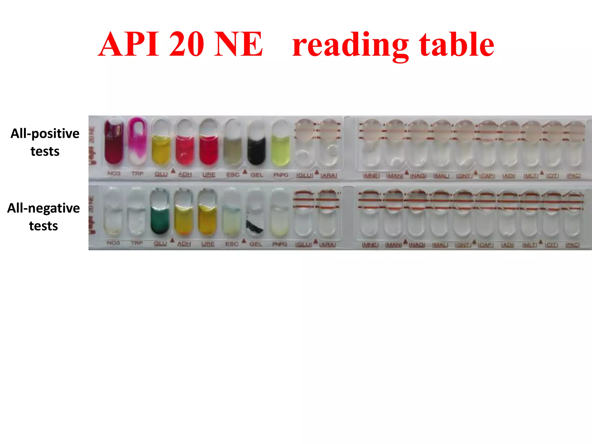 API 20 NE reading table 
All-negative tests 
All-positive tests  