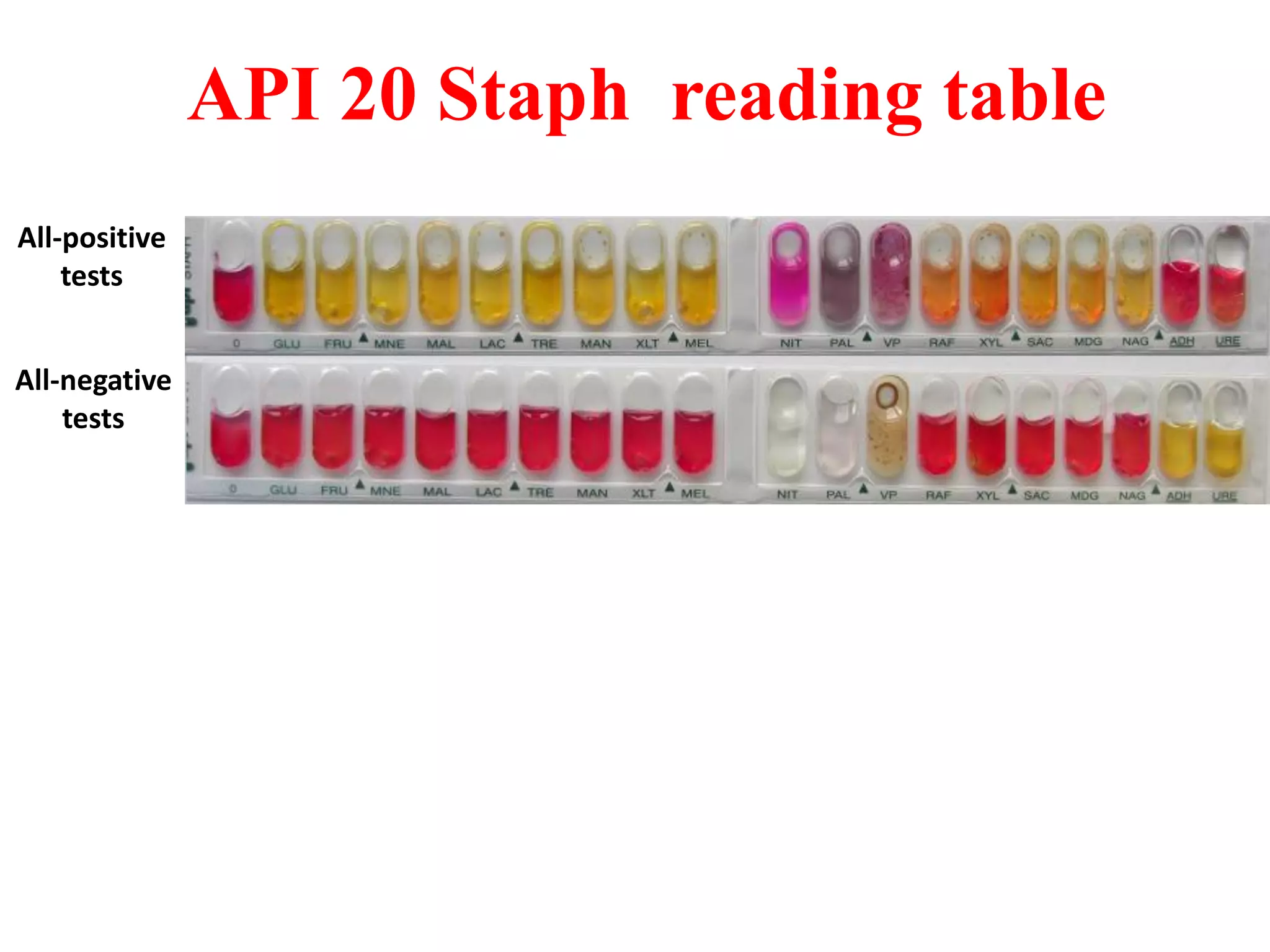 API 20 Staph reading table 
All-positive tests 
All-negative tests  