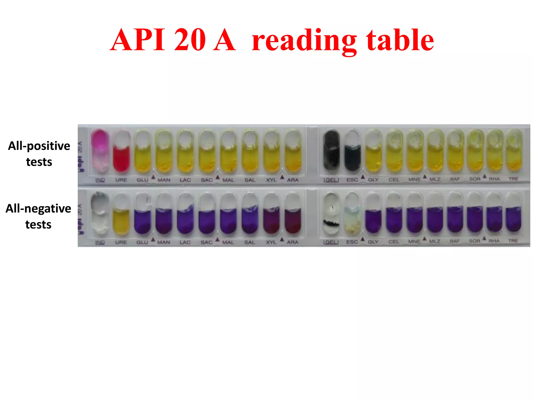 All-positive tests 
All-negative tests 
API 20 A reading table  