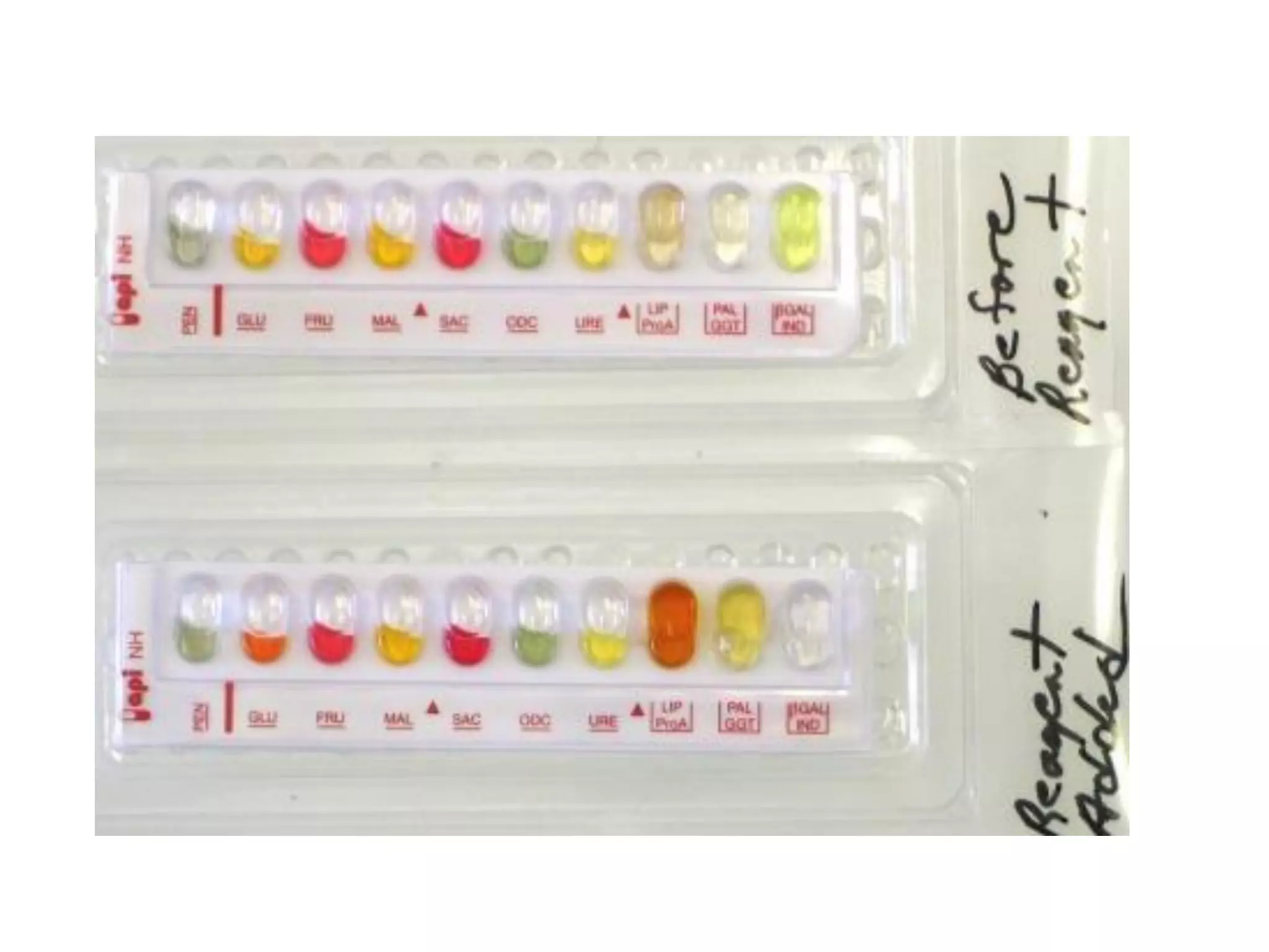 Api test.........بكتريا عملي 