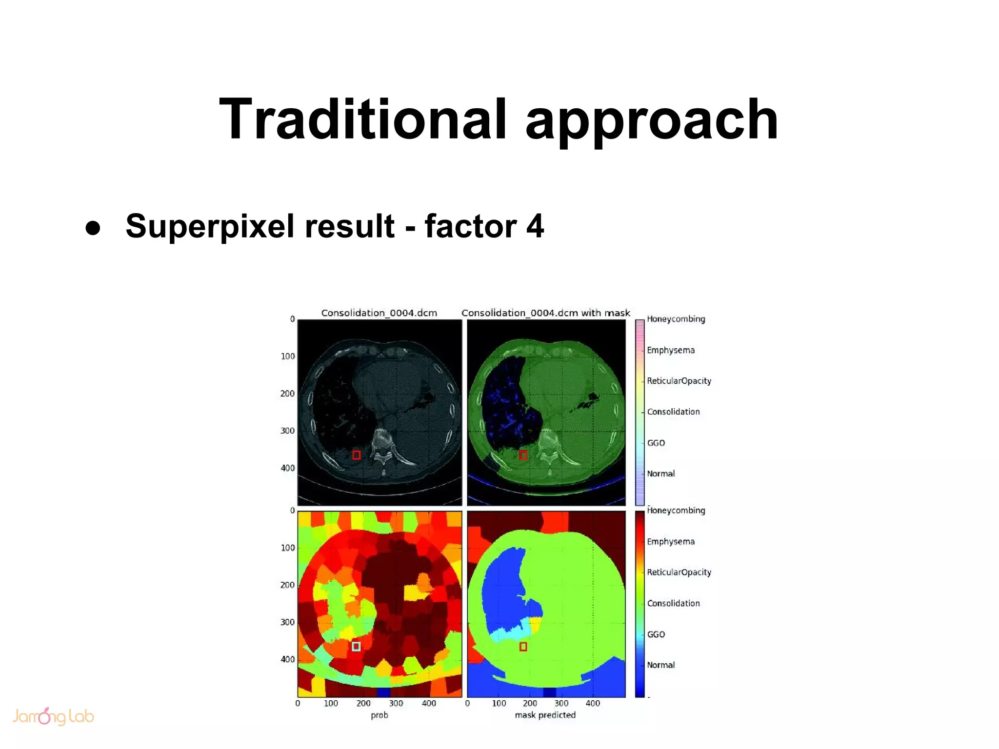 Traditional approach
● Superpixel result - factor 4
 