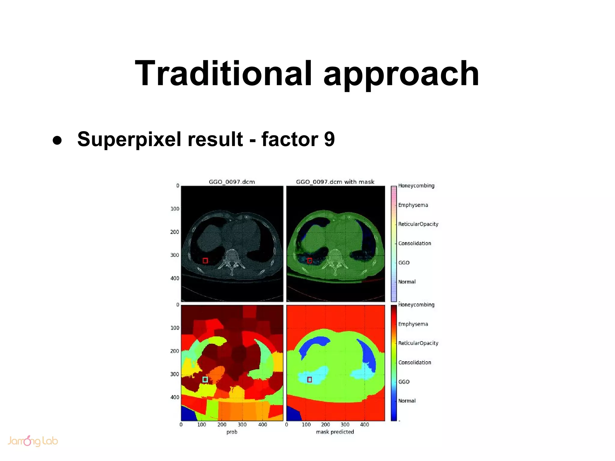 Traditional approach
● Superpixel result - factor 9
 