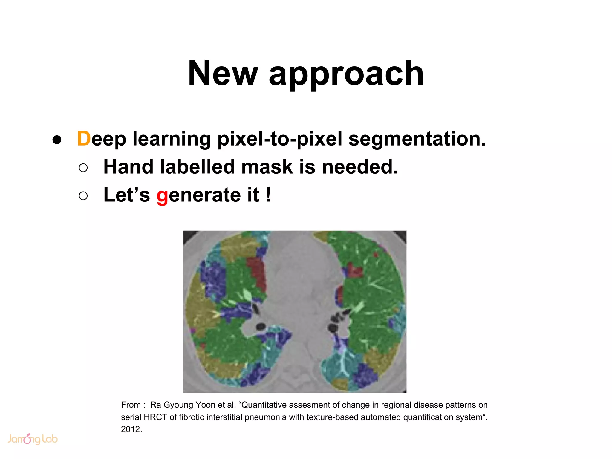 New approach
● Deep learning pixel-to-pixel segmentation.
○ Hand labelled mask is needed.
○ Let’s generate it !
From : Ra Gyoung Yoon et al, “Quantitative assesment of change in regional disease patterns on
serial HRCT of fibrotic interstitial pneumonia with texture-based automated quantification system”.
2012.
 