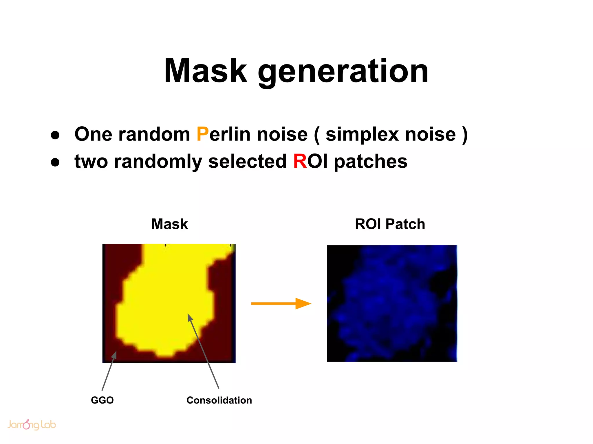 Mask generation
● One random Perlin noise ( simplex noise )
● two randomly selected ROI patches
ConsolidationGGO
Mask ROI Patch
 